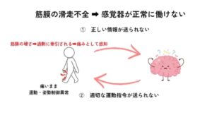 筋膜のエラーの図